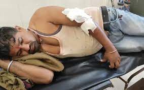 jabalpur, Young man ,work injured 
