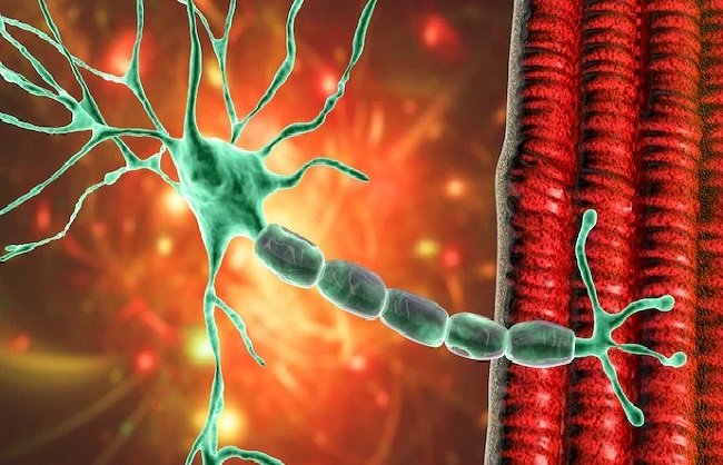 mumbai, First death , GBS in Mumbai