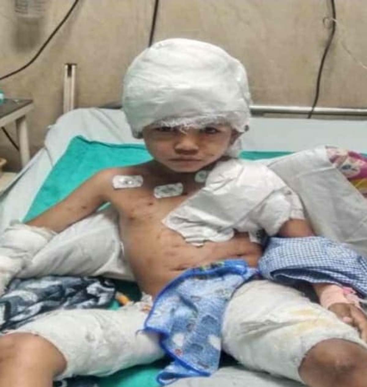 raipur, six year old innocent , stray dogs