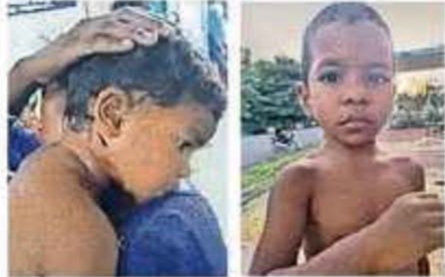 balrampur, Terror of mad dogs ,Ramanujganj