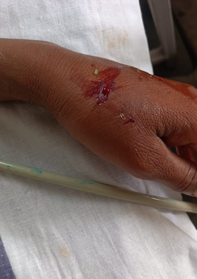 rajgarh,  woman was bitten, removing straw  