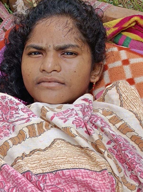 bijapur,   explosion occurred ,  injuring a female Naxalite