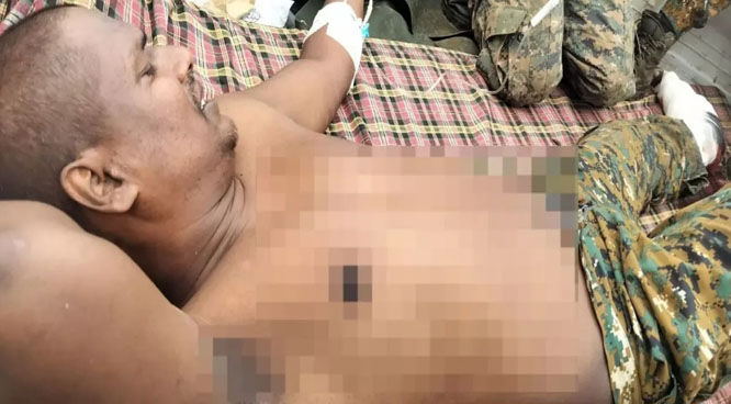 bijapur,   soldier  Cobra battalion , IED blast 