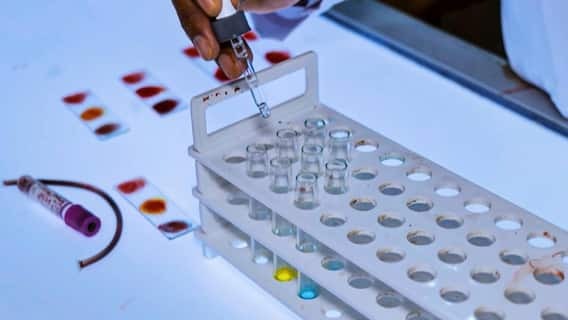 Satna,blood transfusion,six children,HIV