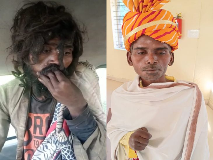  युवक,पांच साल तक नीमच में पागलों की तरह घूमता रहा 